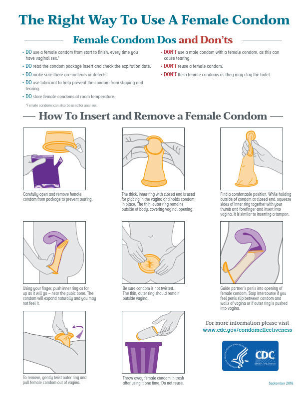 Right Way To Use A Female Condom